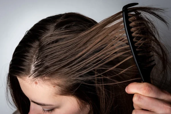 greasy hair treatments at Ayodya Manatunga Academy in Nugegoda.